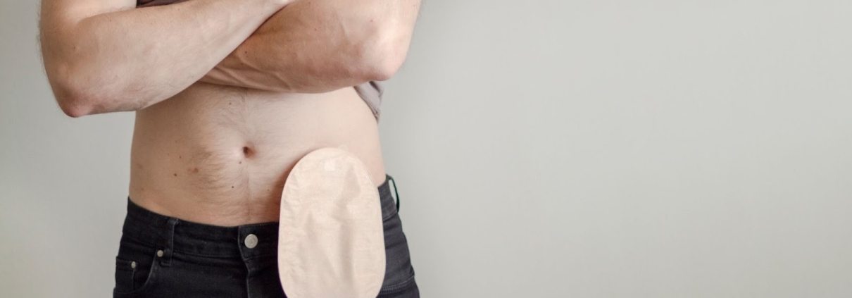 What is the Difference Between an Ostomy and a Colostomy
